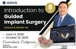 Introduction to Guided Implant Surgery