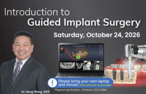Introduction to Guided Implant Surgery